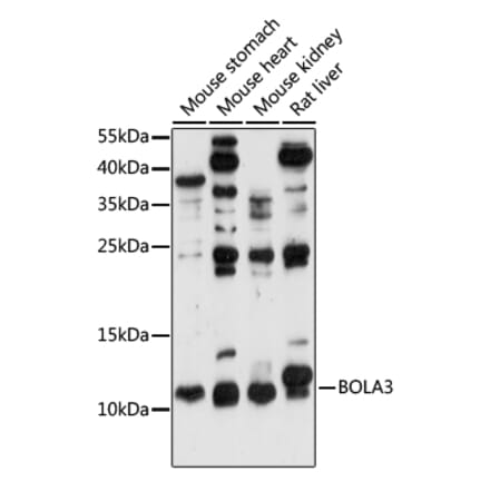 Western Blot - Anti-BOLA3 Antibody (A88123) - Antibodies.com