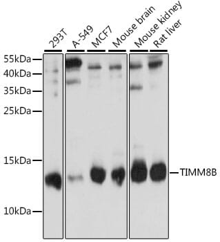Western blot analysis of extracts of various cell lines, using Anti-TIMM8B Antibody (A15814) at 1:1,000 dilution.
Secondary antibody: Goat Anti-Rabbit IgG (H+L) (HRP) (AS014) at 1:10,000 dilution.
Lysates / proteins: 25µg per lane.
Blocking buffer: 3% non-fat dry milk in TBST.
Detection: ECL Basic Kit (RM00020).
Exposure time: 90s.