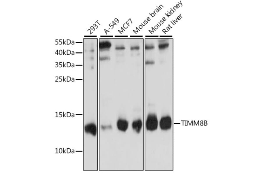 Western Blot - Anti-TIMM8B Antibody (A88124) - Antibodies.com