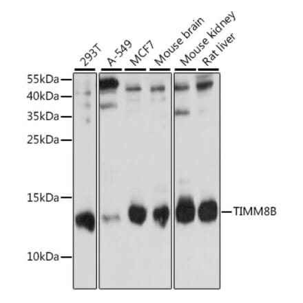 Western Blot - Anti-TIMM8B Antibody (A88124) - Antibodies.com