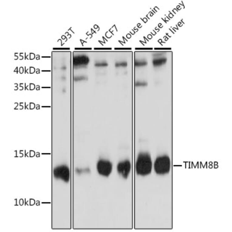 Western Blot - Anti-TIMM8B Antibody (A88124) - Antibodies.com