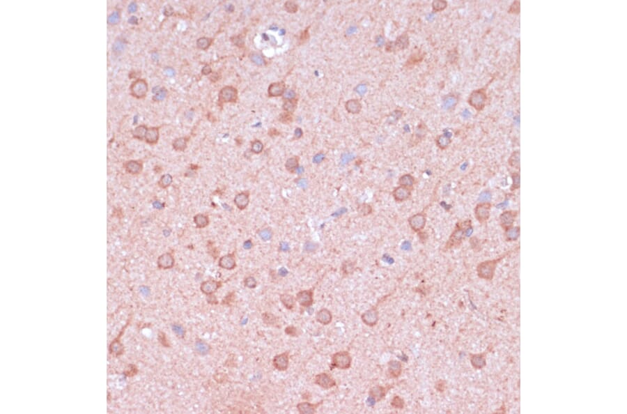 Immunohistochemistry - Anti-TIMM8B Antibody (A88124) - Antibodies.com