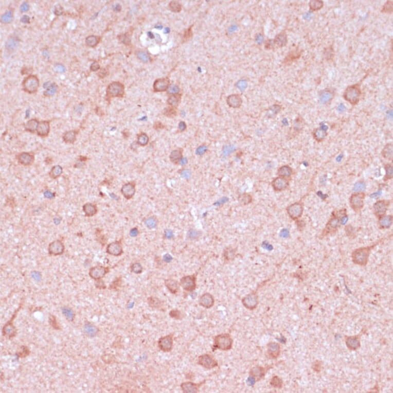 Immunohistochemistry - Anti-TIMM8B Antibody (A88124) - Antibodies.com