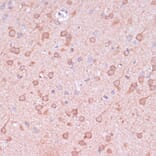 Immunohistochemistry - Anti-TIMM8B Antibody (A88124) - Antibodies.com