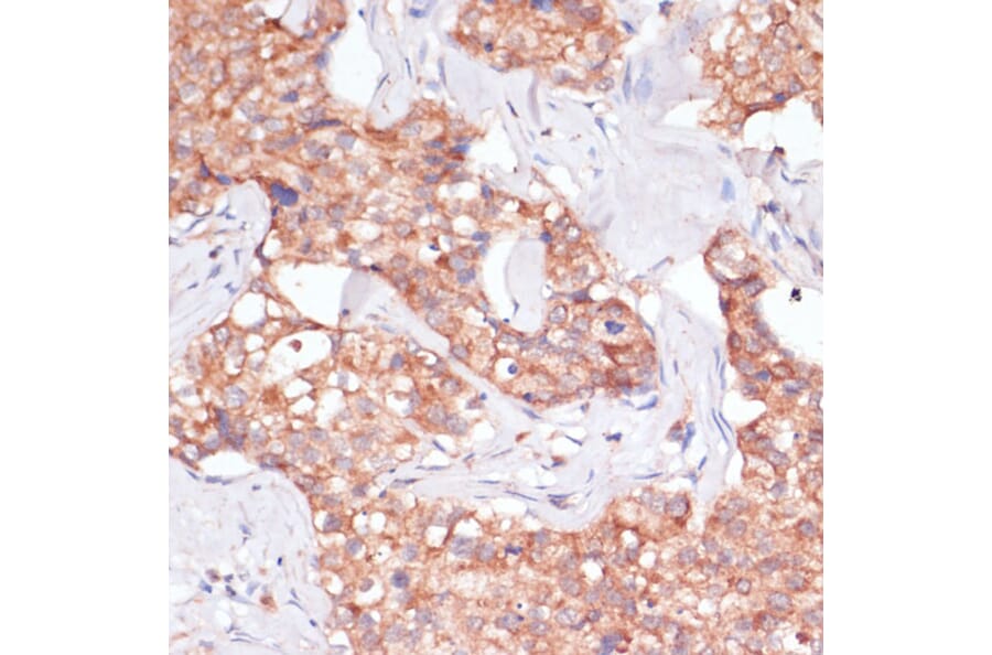 Immunohistochemistry - Anti-TIMM8B Antibody (A88124) - Antibodies.com