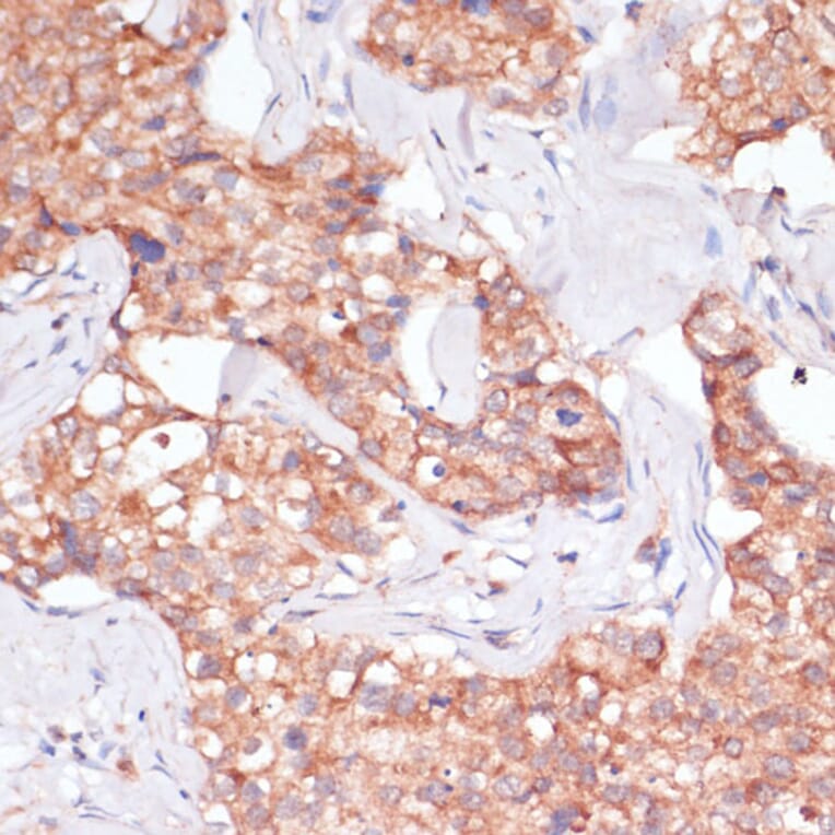 Immunohistochemistry - Anti-TIMM8B Antibody (A88124) - Antibodies.com