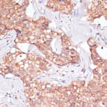 Immunohistochemistry - Anti-TIMM8B Antibody (A88124) - Antibodies.com