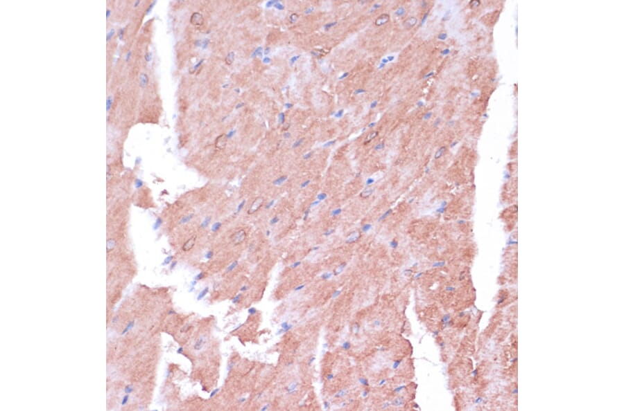 Immunohistochemistry - Anti-TIMM8B Antibody (A88124) - Antibodies.com