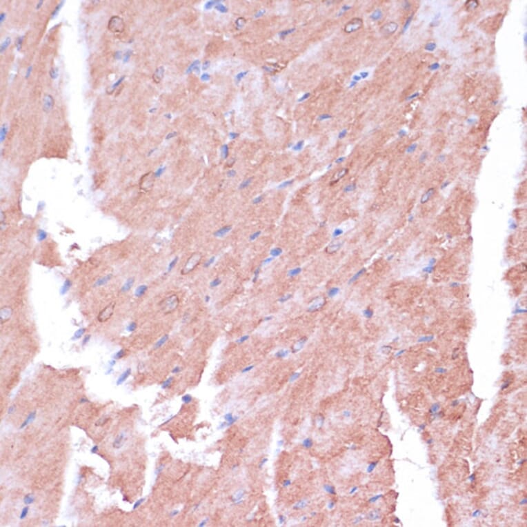 Immunohistochemistry - Anti-TIMM8B Antibody (A88124) - Antibodies.com
