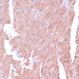 Immunohistochemistry - Anti-TIMM8B Antibody (A88124) - Antibodies.com