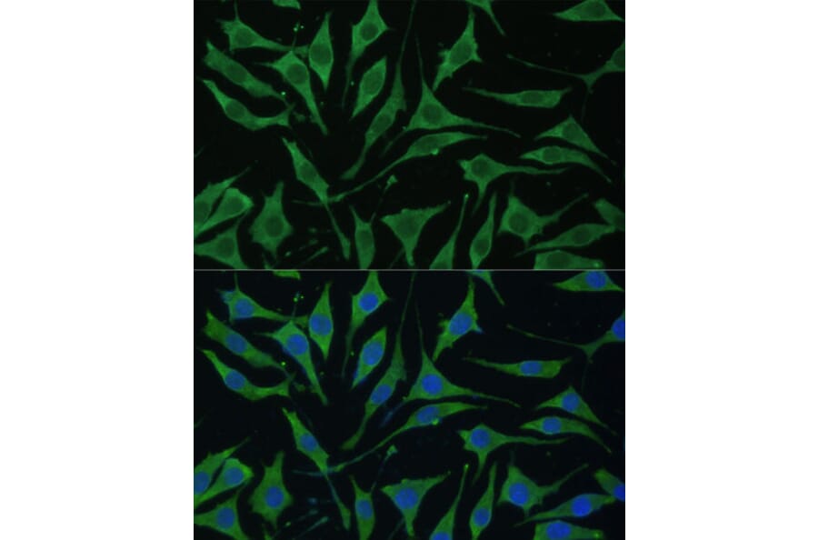 Immunofluorescence - Anti-TIMM8B Antibody (A88124) - Antibodies.com