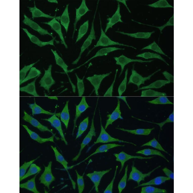 Immunofluorescence - Anti-TIMM8B Antibody (A88124) - Antibodies.com