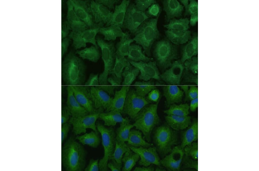 Immunofluorescence - Anti-TIMM8B Antibody (A88124) - Antibodies.com