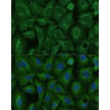 Immunofluorescence - Anti-TIMM8B Antibody (A88124) - Antibodies.com