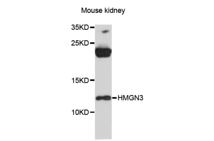 Western Blot - Anti-HMGN3 Antibody (A12649) - Antibodies.com