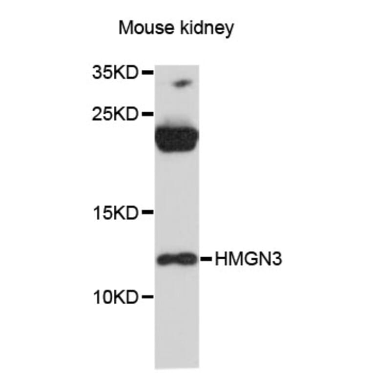 Western Blot - Anti-HMGN3 Antibody (A12649) - Antibodies.com