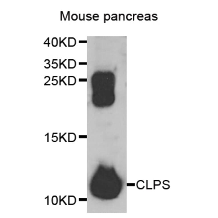 Western Blot - Anti-CLPS Antibody (A13480) - Antibodies.com