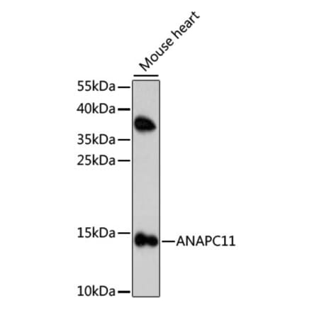 Western Blot - Anti-Apc11 Antibody (A88129) - Antibodies.com