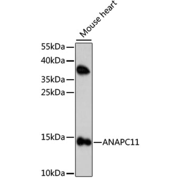 Western Blot - Anti-Apc11 Antibody (A88129) - Antibodies.com