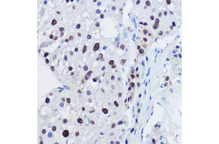 Immunohistochemistry - Anti-Apc11 Antibody (A88129) - Antibodies.com