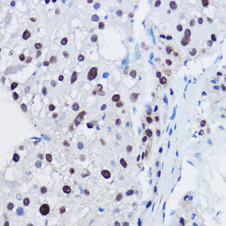 Immunohistochemistry - Anti-Apc11 Antibody (A88129) - Antibodies.com