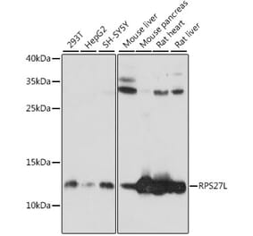 Western Blot - Anti-RPS27L Antibody (A88130) - Antibodies.com