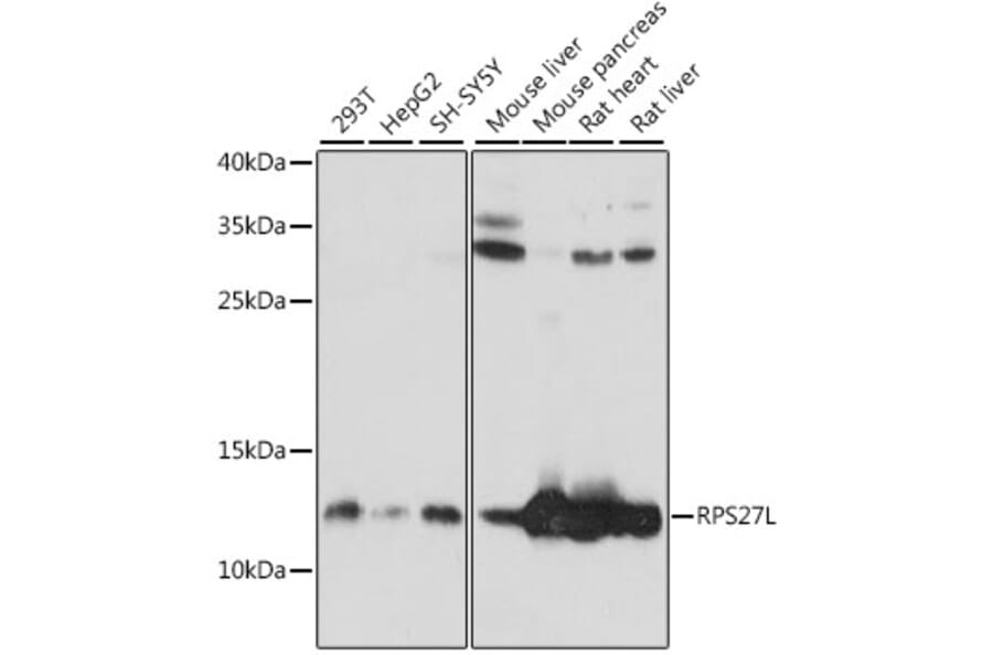 Western Blot - Anti-RPS27L Antibody (A88130) - Antibodies.com