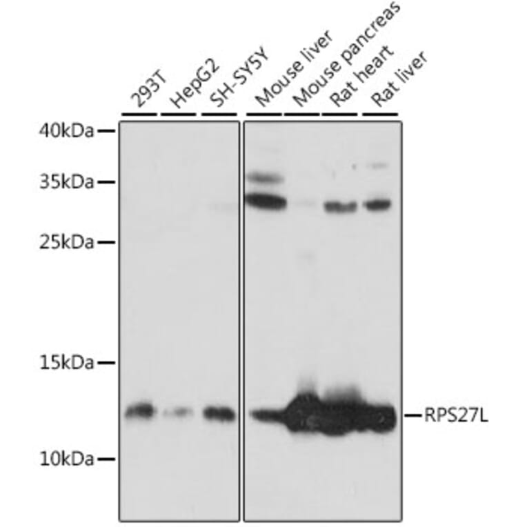 Western Blot - Anti-RPS27L Antibody (A88130) - Antibodies.com