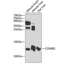 Western Blot - Anti-COX6B1 Antibody (A88131) - Antibodies.com