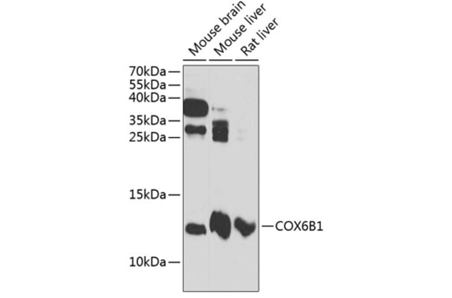 Western Blot - Anti-COX6B1 Antibody (A88131) - Antibodies.com