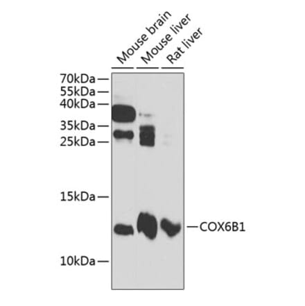 Western Blot - Anti-COX6B1 Antibody (A88131) - Antibodies.com