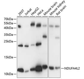 Western Blot - Anti-NDUFA4L2 Antibody (A88132) - Antibodies.com