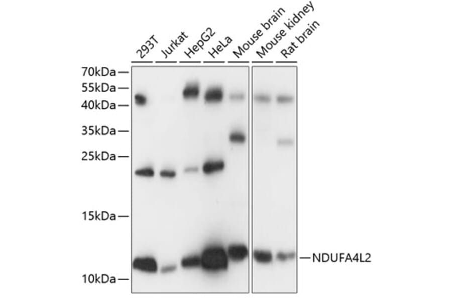 Western Blot - Anti-NDUFA4L2 Antibody (A88132) - Antibodies.com