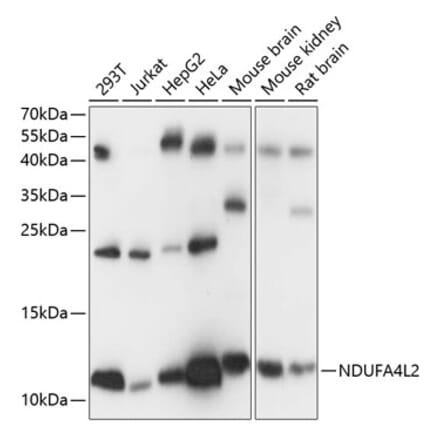 Western Blot - Anti-NDUFA4L2 Antibody (A88132) - Antibodies.com