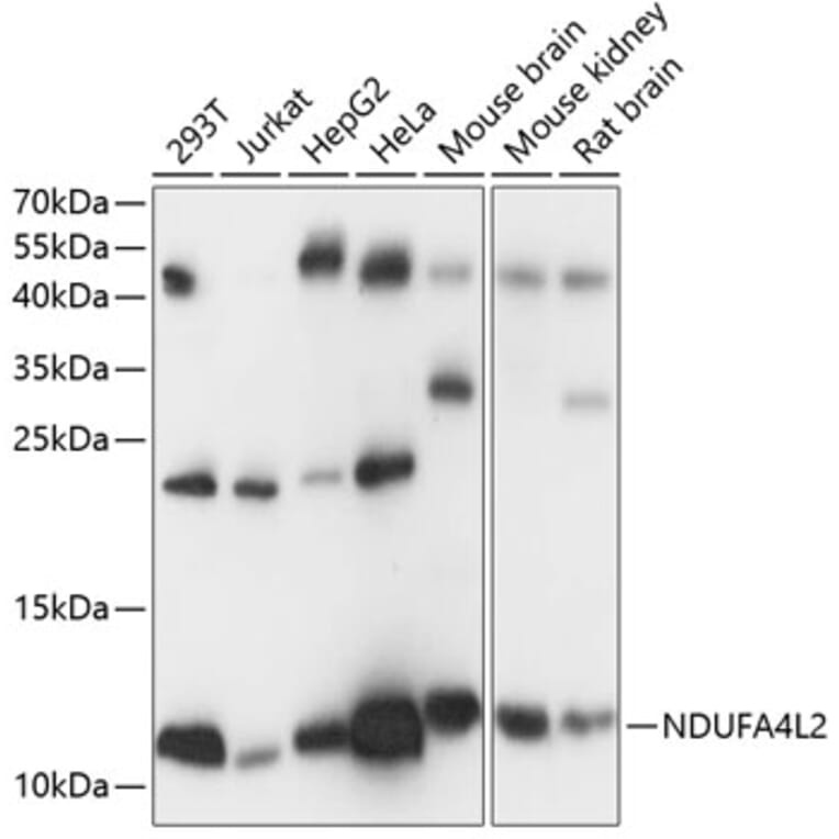 Western Blot - Anti-NDUFA4L2 Antibody (A88132) - Antibodies.com