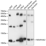Western Blot - Anti-NDUFA4L2 Antibody (A88132) - Antibodies.com