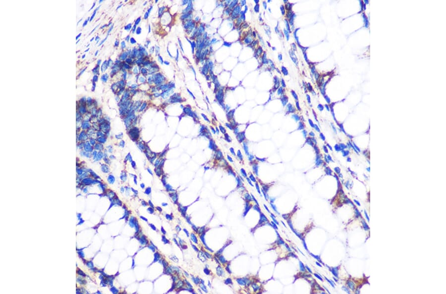 Immunohistochemistry - Anti-NDUFA4L2 Antibody (A88132) - Antibodies.com
