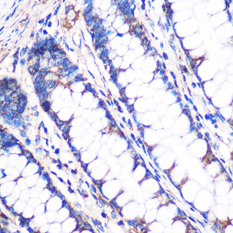 Immunohistochemistry - Anti-NDUFA4L2 Antibody (A88132) - Antibodies.com
