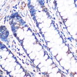 Immunohistochemistry - Anti-NDUFA4L2 Antibody (A88132) - Antibodies.com