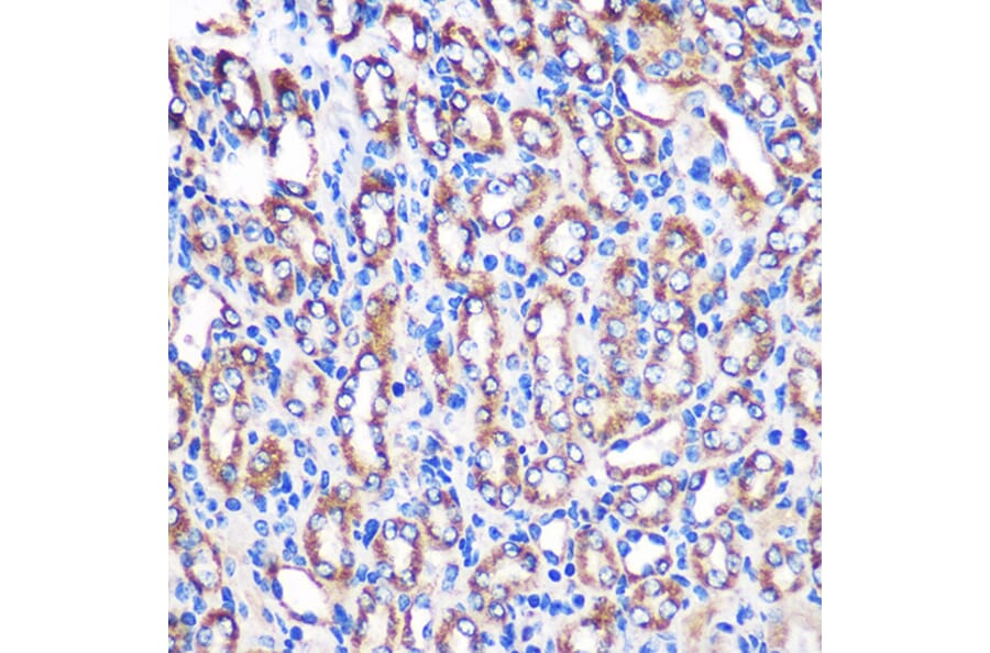 Immunohistochemistry - Anti-NDUFA4L2 Antibody (A88132) - Antibodies.com