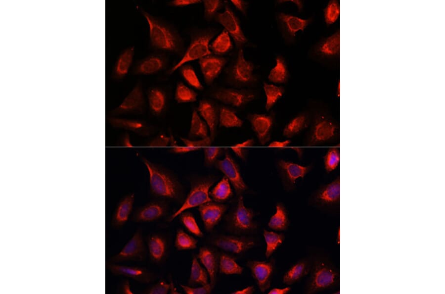 Immunofluorescence - Anti-NDUFA4L2 Antibody (A88132) - Antibodies.com