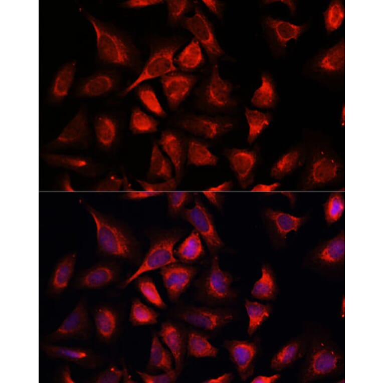 Immunofluorescence - Anti-NDUFA4L2 Antibody (A88132) - Antibodies.com