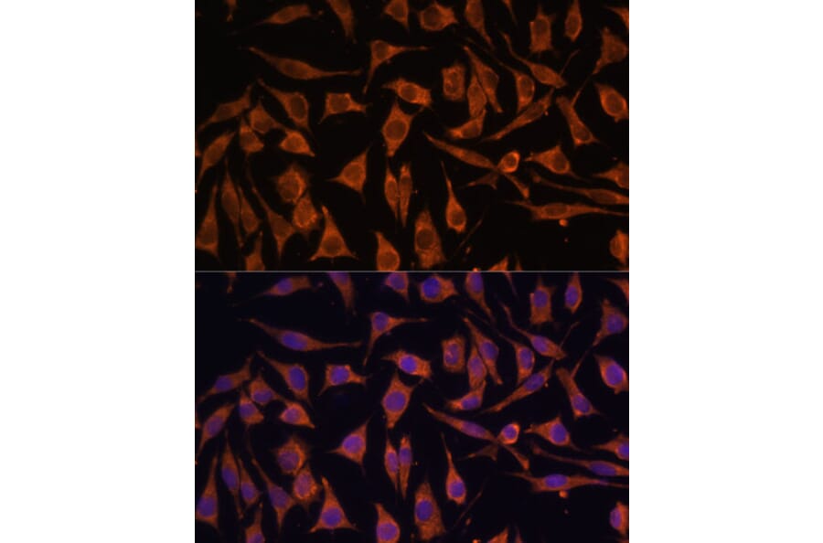 Immunofluorescence - Anti-NDUFA4L2 Antibody (A88132) - Antibodies.com