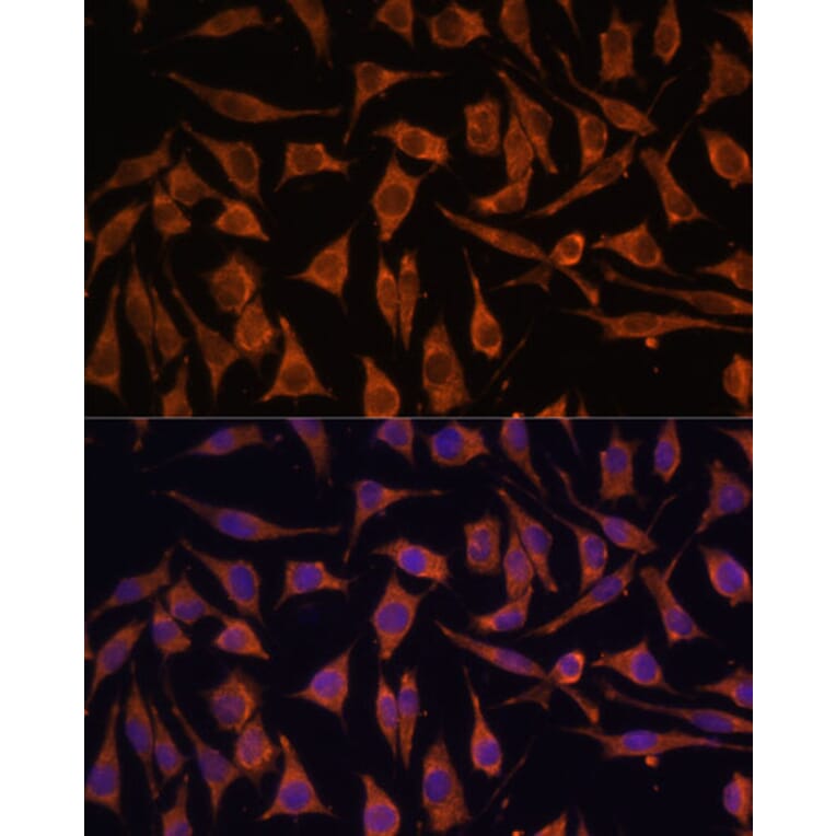 Immunofluorescence - Anti-NDUFA4L2 Antibody (A88132) - Antibodies.com