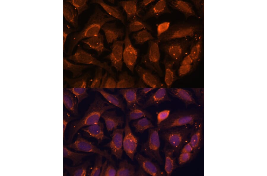 Immunofluorescence - Anti-NDUFA4L2 Antibody (A88132) - Antibodies.com