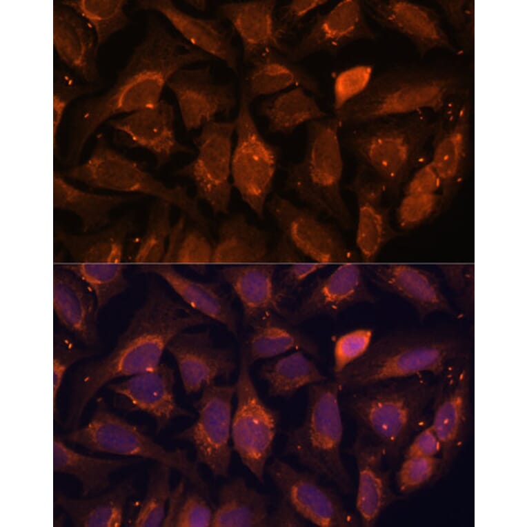 Immunofluorescence - Anti-NDUFA4L2 Antibody (A88132) - Antibodies.com