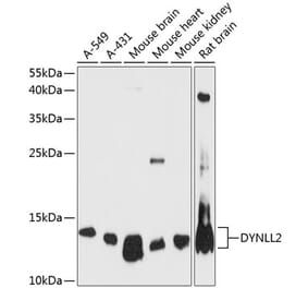 Western Blot - Anti-Dynein Antibody (A88133) - Antibodies.com