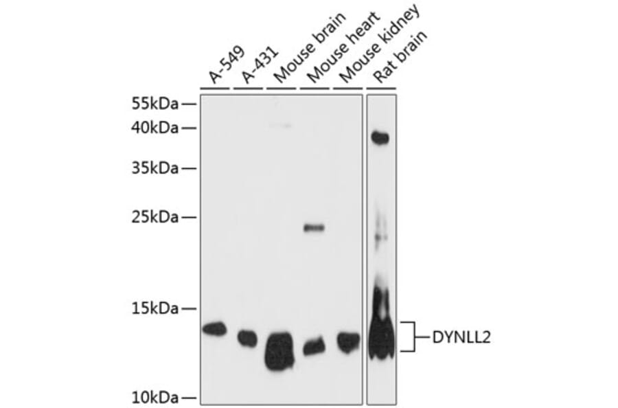 Western Blot - Anti-Dynein Antibody (A88133) - Antibodies.com