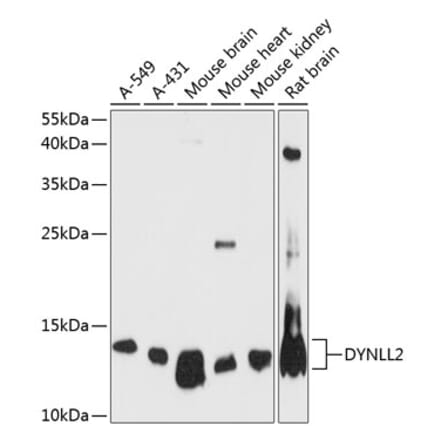 Western Blot - Anti-Dynein Antibody (A88133) - Antibodies.com