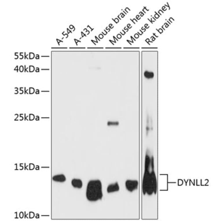 Western Blot - Anti-Dynein Antibody (A88133) - Antibodies.com